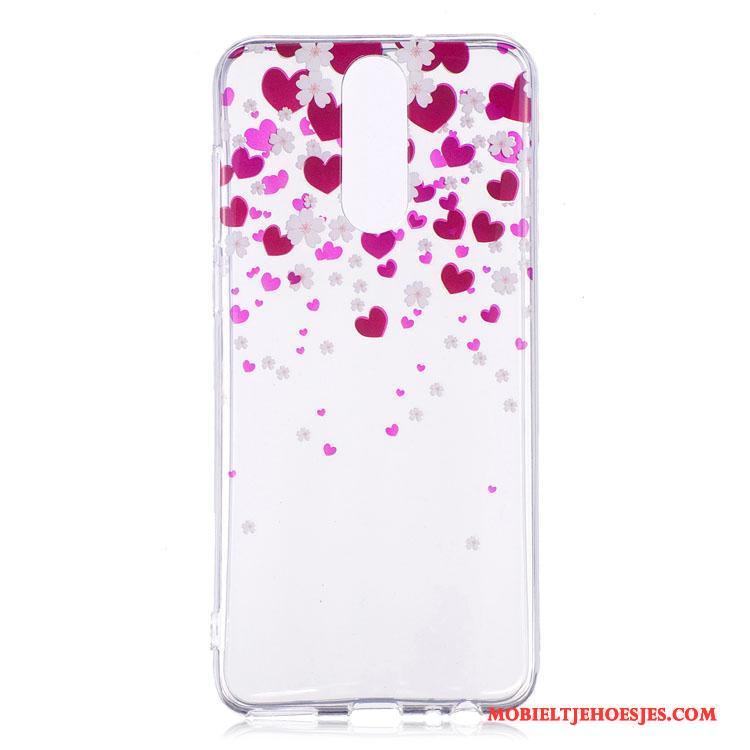 Huawei Mate 10 Lite Hoesje Hoes Bescherming Jeugd All Inclusive Siliconen Hanger Roze